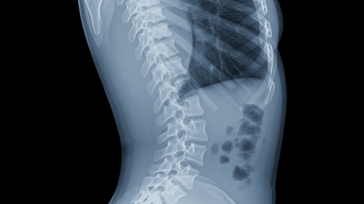 Жир вместо скальпеля: ученые нашли способ, как помочь костям регенерировать